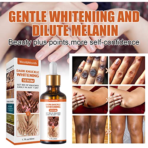 Skin Brightening Serum – Natural Glow, Dark Spot Removal & Hydration
