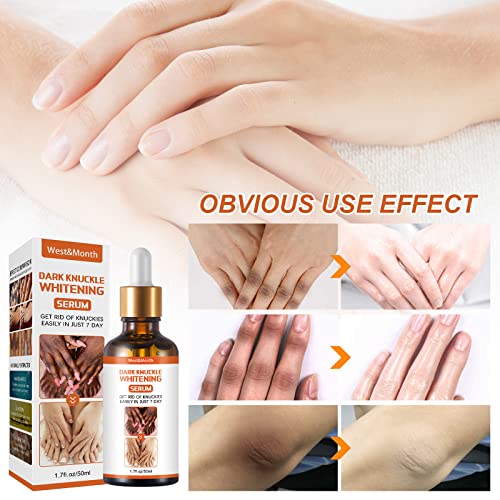 Skin Brightening Serum – Natural Glow, Dark Spot Removal & Hydration