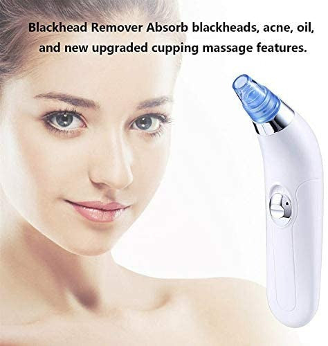 ✨ Blackhead Remover – Vacuum Suction Pore Cleaner for Face