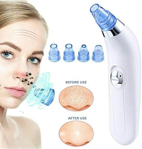 ✨ Blackhead Remover – Vacuum Suction Pore Cleaner for Face
