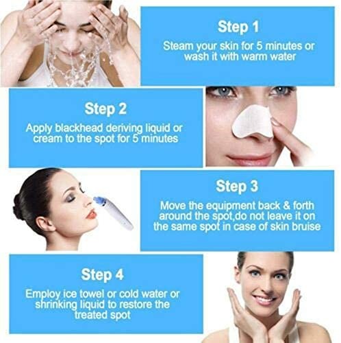 ✨ Blackhead Remover – Vacuum Suction Pore Cleaner for Face