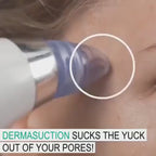 ✨ Blackhead Remover – Vacuum Suction Pore Cleaner for Face